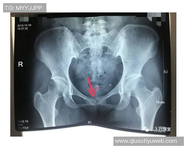 尼科威廉姆斯谈耻骨炎恢复过程并表示需带伤出战的挑战与决心 尼科威廉姆斯谈耻骨炎恢复过程并表示需带伤出战的挑战与决心